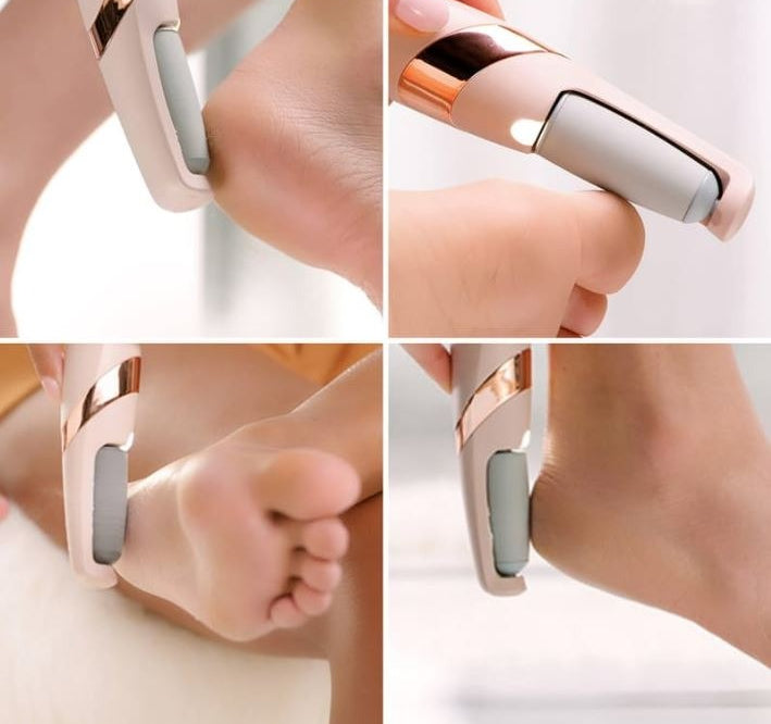 Electric Foot Callus Remover – Smooth & Soft Feet in Minutes